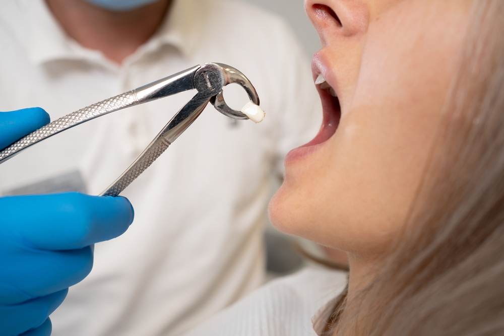 Tooth Extraction In Gardner MA